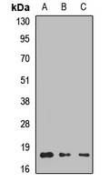 LAMTOR1 Rabbit Polyclonal Antibody