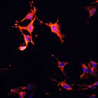 LAMTOR1 Rabbit Polyclonal Antibody