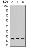 CHMP1A Rabbit Polyclonal Antibody
