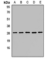 OCIAD1 Rabbit Polyclonal Antibody