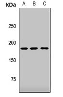 ZCCHC11 Rabbit Polyclonal Antibody