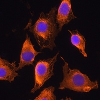 ZCCHC11 Rabbit Polyclonal Antibody