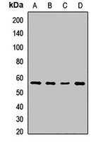 SPTLC2 Rabbit Polyclonal Antibody