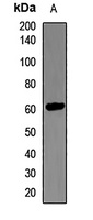LCAT Rabbit Polyclonal Antibody