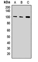 Exportin-T Rabbit Polyclonal Antibody