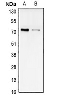 STRA6 Rabbit Polyclonal Antibody