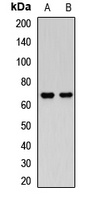 NET1 Rabbit Polyclonal Antibody