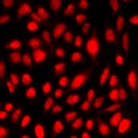 NET1 Rabbit Polyclonal Antibody