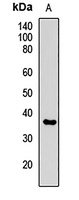 SRPX Rabbit Polyclonal Antibody
