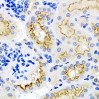 SRPX Rabbit Polyclonal Antibody