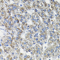 FUCA2 Rabbit Polyclonal Antibody