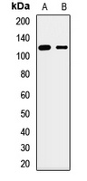 SLC12A7 Rabbit Polyclonal Antibody