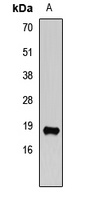 VAMP2 Rabbit Polyclonal Antibody