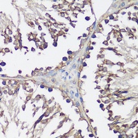 VAMP2 Rabbit Polyclonal Antibody