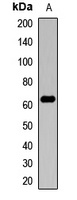 Amphiphysin 2 Rabbit Polyclonal Antibody
