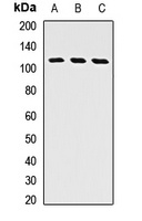 GGCX Rabbit Polyclonal Antibody