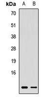 Rbx1 Rabbit Polyclonal Antibody