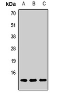 POLR2J Rabbit Polyclonal Antibody