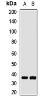GNB1 Rabbit Polyclonal Antibody