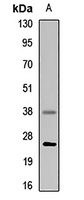 Cathepsin S Rabbit Polyclonal Antibody