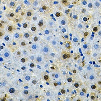 BUB1 Rabbit Polyclonal Antibody