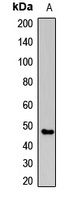 CLN3 Rabbit Polyclonal Antibody