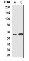 Cytochrome P450 5A1 Rabbit Polyclonal Antibody
