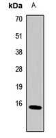 Metallothionein-2A Rabbit Polyclonal Antibody