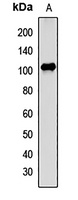 ALIX Rabbit Polyclonal Antibody