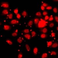 Histone H3 (TriMethyl-K27) Antibody