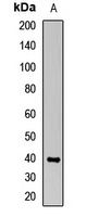 OAS1 Rabbit Polyclonal Antibody