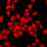 OAS1 Rabbit Polyclonal Antibody