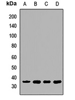 EB1 Rabbit Polyclonal Antibody