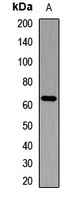 IGF2BP2 Antibody