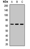 GRK1 Rabbit Polyclonal Antibody