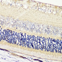 GRK1 Rabbit Polyclonal Antibody