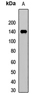NFAT1 Rabbit Polyclonal Antibody