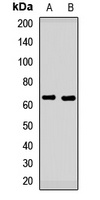 Alpha-internexin Rabbit Polyclonal Antibody