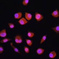 NPLOC4 Rabbit Polyclonal Antibody