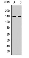 KIF5A Rabbit Polyclonal Antibody