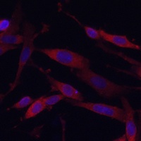 KIF5A Rabbit Polyclonal Antibody