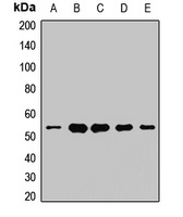 UQCRC1 Antibody