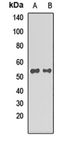 STAU2 Rabbit Polyclonal Antibody