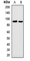 GUCY2D Rabbit Polyclonal Antibody