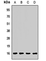 ARF5 Rabbit Polyclonal Antibody