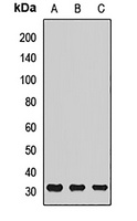 ATP6V1E1 Rabbit Polyclonal Antibody