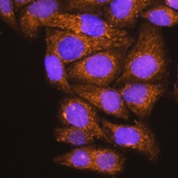 ATP6V1E1 Rabbit Polyclonal Antibody