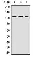 EXTL3 Rabbit Polyclonal Antibody