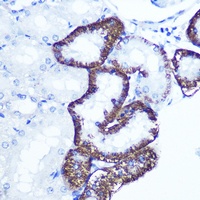 EXTL3 Rabbit Polyclonal Antibody