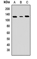 GART Rabbit Polyclonal Antibody